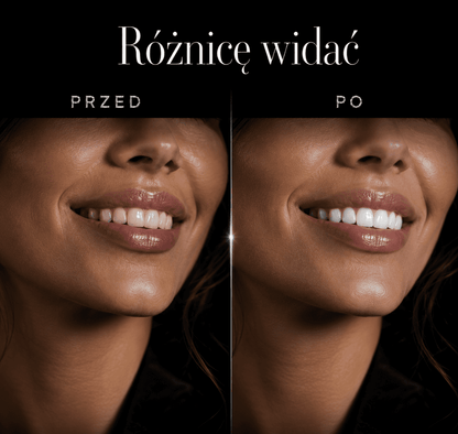 Paski Wybielające WHITIO